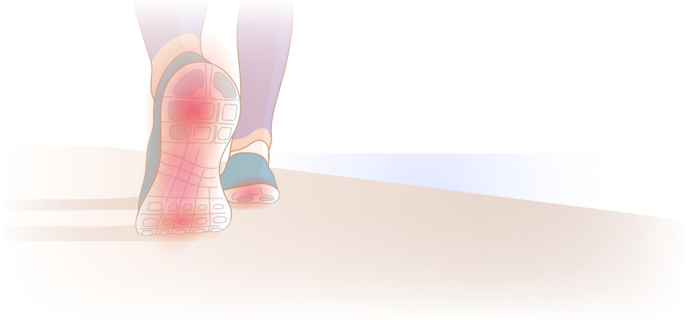 heel pain running