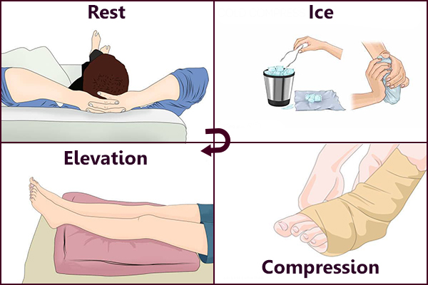 rest, ice, compression and elevation