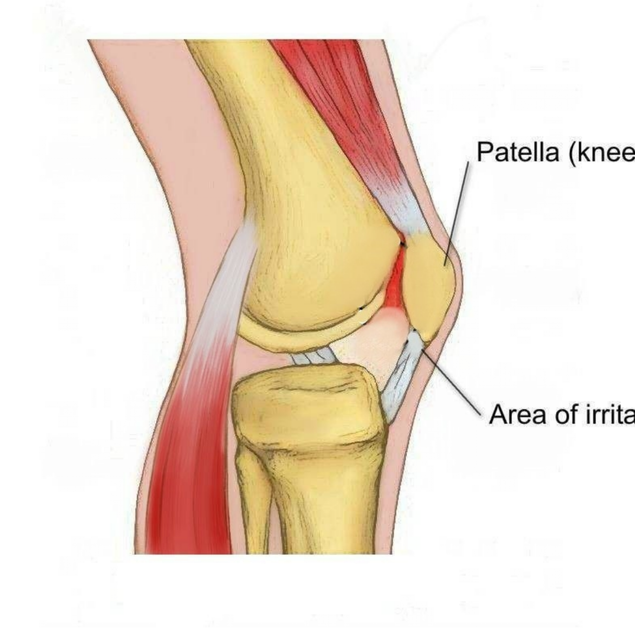 Сильные боли при разгибании колена. Коленный сустав строение пателла. Коленная чашечка анатомия. Хондропатия надколенника.