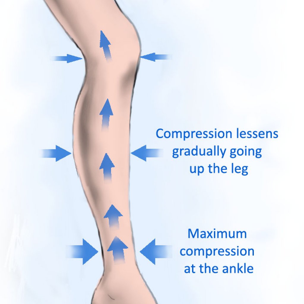 Do Copper Compression Socks Really Work? WalkJogRun